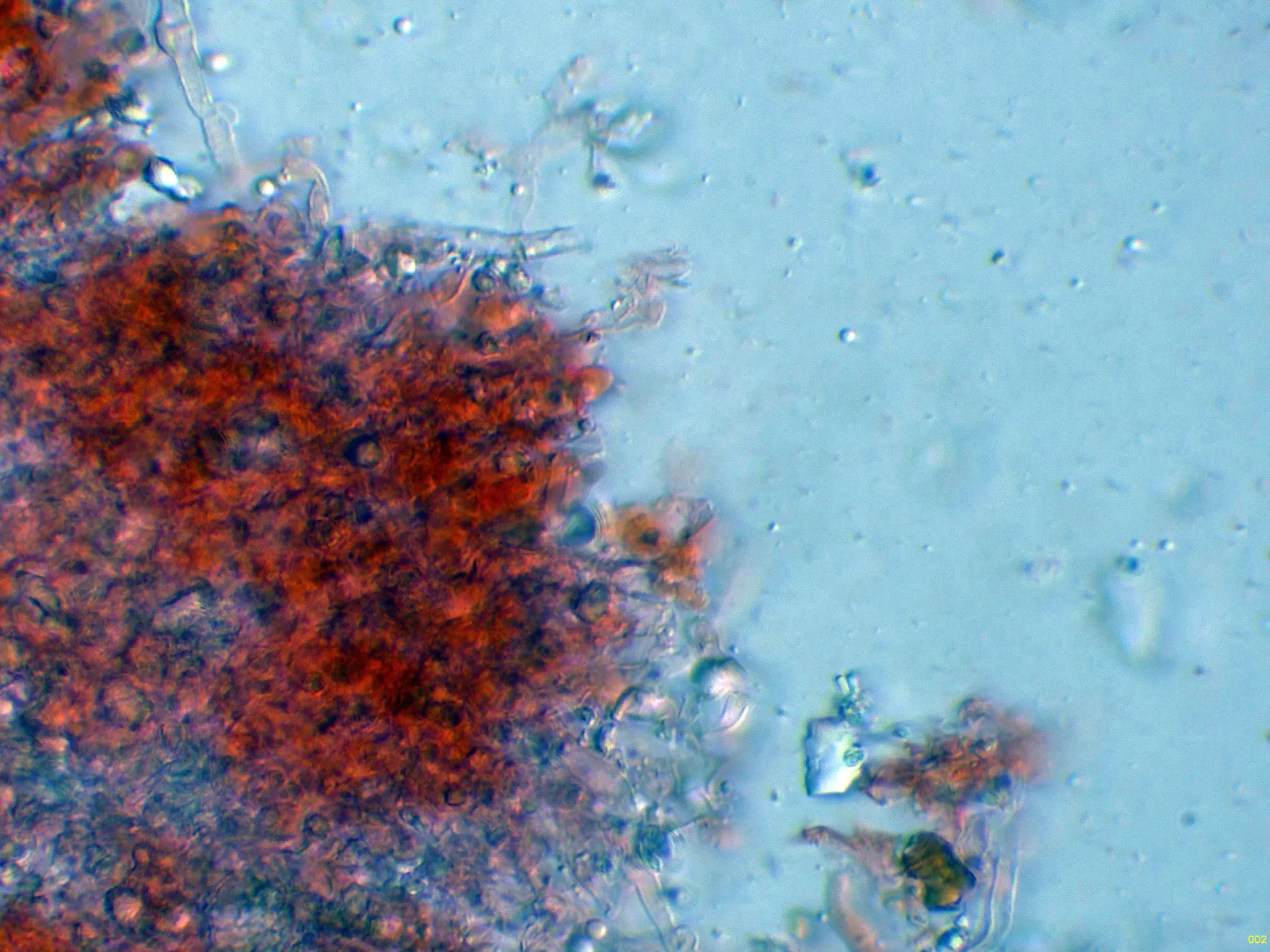 Microscopía de Lyomyces mascarensis - 10 - Basidios-002